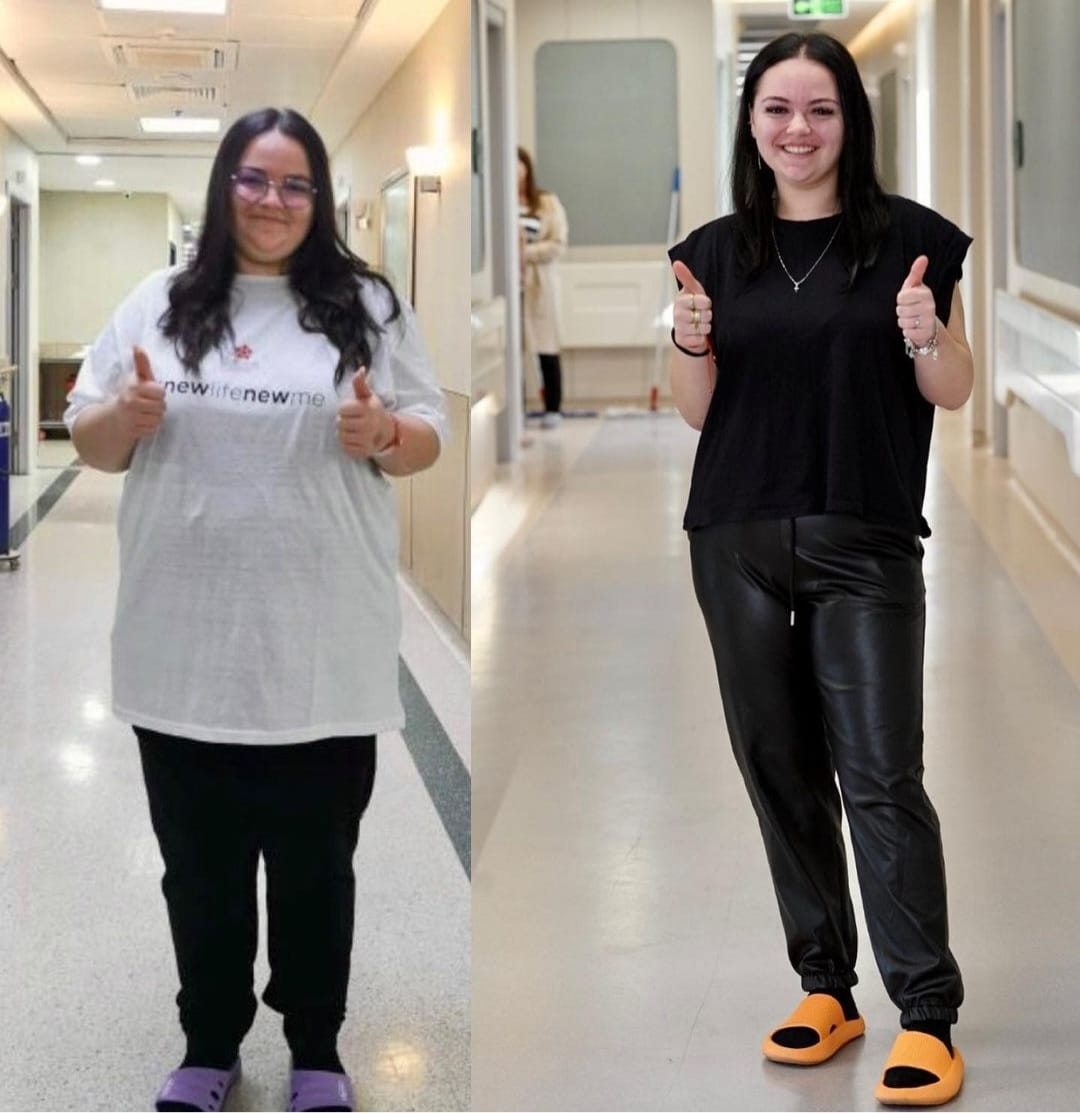 מיני מעקף בגיאורגיה