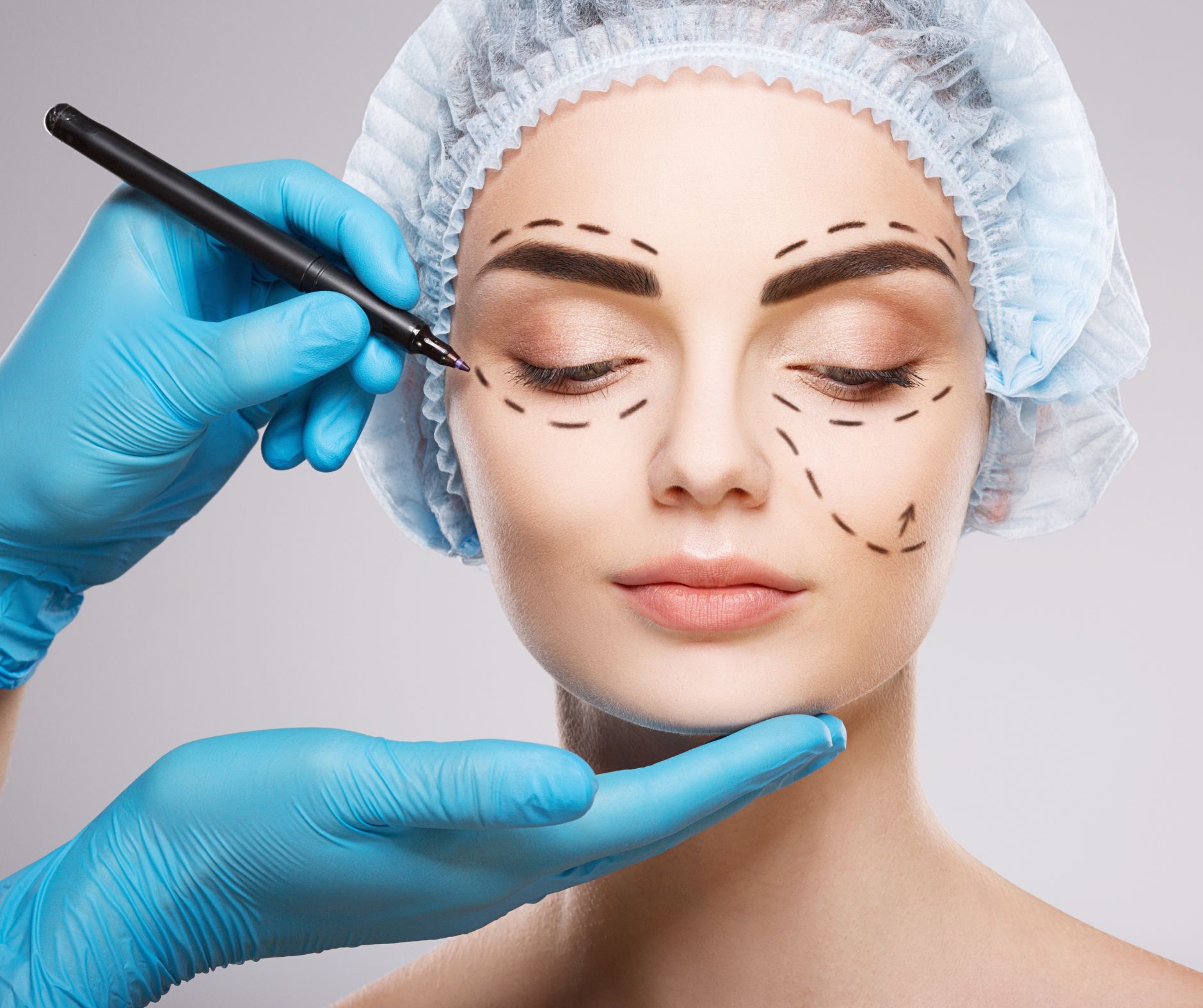 ניתוח מיני מעקף