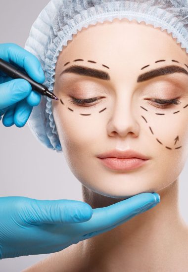 ניתוח מיני מעקף